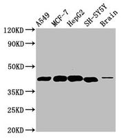 Western Blot Positive WB detected in: A549 whole cell lysate, MCF-7 whole cell lysate, HepG2 whole cell lysate, SH-SY5Y whole cell lysate, Rat brain tissue All lanes: DLK1 antibody at 4.6µg/ml Secondary Goat polyclonal to rabbit IgG at 1/50000 dil...