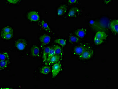 Immunofluorescent analysis of MCF-7 cells using CSB-PA006949LA01HU at dilution of 1:100 and Alexa Fluor 488-congugated AffiniPure Goat Anti-Rabbit IgG(H+L)