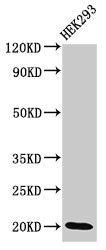 Western Blot Positive WB detected in: HEK293 whole cell lysate All lanes: DLX6 antibody at 3.4ug/ml Secondary Goat polyclonal to rabbit IgG at 1/50000 dilution Predicted band size: 20, 30, 33 kDa Observed band size: 20 kDa