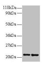Western blot All lanes: RPS9 antibody at 2µg/ml Lane 1: 293T whole cell lysate Lane 2: EC109 whole cell lysate Secondary Goat polyclonal to rabbit IgG at 1/15000 dilution Predicted band size: 21 kDa Observed band size: 21 kDa