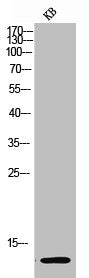 Western Blot analysis of KB cells using Acetyl-Histone H4 (K12) Polyclonal Antibody
