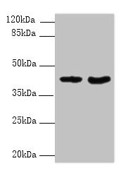Western blot All lanes: DMKN antibody at 6µg/ml Lane 1: Mouse kidney tissue Lane 2: Mouse liver tissue Secondary Goat polyclonal to rabbit IgG at 1/10000 dilution Predicted band size: 48, 16, 37, 46, 39, 42, 36, 21, 19, 17, 15, 10, 47 kDa Observed...