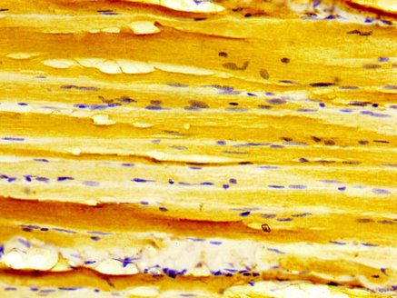 IHC image of CSB-PA006968LA01HU diluted at 1:500 and staining in paraffin-embedded human skeletal muscle tissue performed on a Leica BondTM system. After dewaxing and hydration, antigen retrieval was mediated by high pressure in a citrate buffer (...