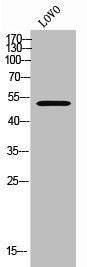 Western Blot analysis of LOVO cells using FoxN4 Polyclonal Antibody