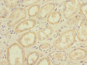 Immunohistochemistry of paraffin-embedded human kidney tissue using CSB-PA006982LA01HU at dilution of 1:100