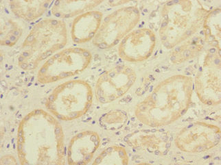 Immunohistochemistry of paraffin-embedded human kidney tissue using CSB-PA006982LA01HU at dilution of 1:100