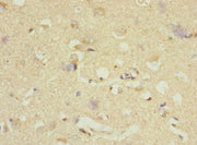 Immunohistochemistry of paraffin-embedded human brain tissue using CSB-PA007008DSR1HU at dilution of 1:100