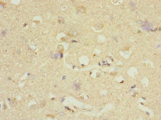 Immunohistochemistry of paraffin-embedded human brain tissue using CSB-PA007008DSR1HU at dilution of 1:100