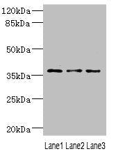 Western blot All lanes: DNAJB2 antibody at 1.18ug/ml Lane 1: 293T whole cell lysate Lane 2: PC-3 whole cell lysate Lane 3: A431 whole cell lysate Secondary Goat polyclonal to rabbit IgG at 1/10000 dilution Predicted band size: 36, 31 kDa Observed...