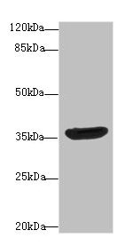Western blot All lanes: DNAJB2 antibody at 10µg/ml + A431 whole cell lysate Secondary Goat polyclonal to rabbit IgG at 1/10000 dilution Predicted band size: 36, 31 kDa Observed band size: 36 kDa