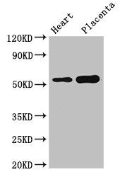 Western Blot Positive WB detected in: Mouse heart tissue, Human placenta tissue All lanes: DOK3 antibody at 3µg/ml Secondary Goat polyclonal to rabbit IgG at 1/50000 dilution Predicted band size: 54, 24, 36, 25 kDa Observed band size: 54 kDa