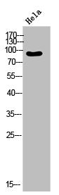 Western Blot analysis of HeLa cells using Repetin Polyclonal Antibody