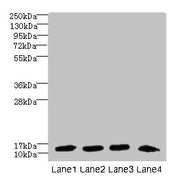 Western blot All lanes: DNAL4 antibody at 1.5µg/ml Lane 1: Mouse gonadal tissue Lane 2: HL60 whole cell lysate Lane 3: NIH/3T3 whole cell lysate Lane 4: Mouse brain tissue Secondary Goat polyclonal to rabbit IgG at 1/10000 dilution Predicted band...
