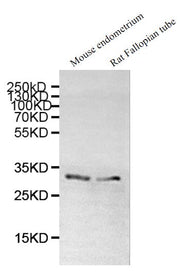 Western Blot Positive WB detected in:Mouse endometrium tissue lysate, Rat Fallopian tube tissue lysate All lanes: DNALI1 antibody at 1:1000 Secondary Goat polyclonal to rabbit IgG at 1/50000 dilution Predicted band size: 30, 16 kDa Observed band s...