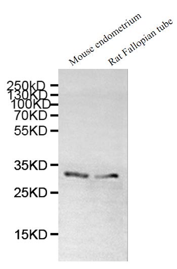 Western Blot Positive WB detected in:Mouse endometrium tissue lysate, Rat Fallopian tube tissue lysate All lanes: DNALI1 antibody at 1:1000 Secondary Goat polyclonal to rabbit IgG at 1/50000 dilution Predicted band size: 30, 16 kDa Observed band s...