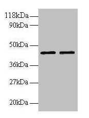 Western blot All lanes: B4GALT3 antibody at 2µg/ml Lane 1: EC109 whole cell lysate Lane 2: 293T whole cell lysate Secondary Goat polyclonal to rabbit IgG at 1/15000 dilution Predicted band size: 44, 16 kDa Observed band size: 44 kDa