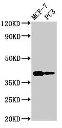 Western Blot Positive WB detected in: MCF-7 whole cell lysate, PC-3 whole cell lysate All lanes: DNASE2 antibody at 2.7ug/ml Secondary Goat polyclonal to rabbit IgG at 1/50000 dilution Predicted band size: 40, 34 kDa Observed band size: 40 kDa