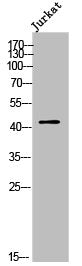 Western Blot analysis of Jurkat cells using Olfactory receptor 2AJ1 Polyclonal Antibody