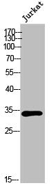 Western Blot analysis of Jurkat cells using Olfactory receptor 6P1 Polyclonal Antibody