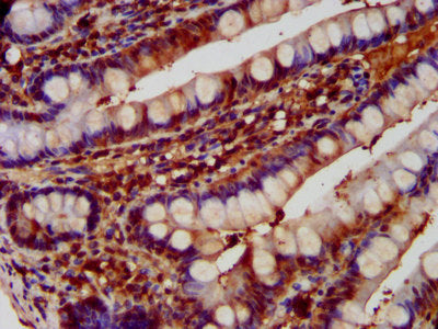 IHC image of CSB-PA007087LA01HU diluted at 1:600 and staining in paraffin-embedded human small intestine tissue performed on a Leica BondTM system. After dewaxing and hydration, antigen retrieval was mediated by high pressure in a citrate buffer (...