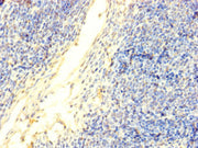Immunohistochemistry of paraffin-embedded human thymus tissue using CSB-PA007088LA01HU at dilution of 1:100