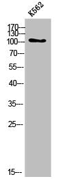 Western Blot analysis of K562 cells using COL6A2 Polyclonal Antibody