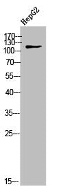 Western Blot analysis of HepG2 cells using COL9A1 Polyclonal Antibody