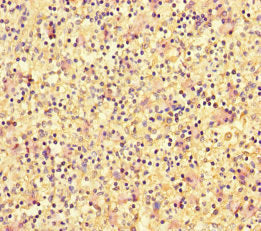 Immunohistochemistry of paraffin-embedded human spleen tissue using CSB-PA007108LA01HU at dilution of 1:100