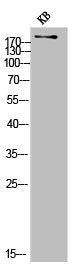 Western Blot analysis of KB cells using COL11A1 Polyclonal Antibody