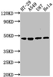 Western Blot Positive WB detected in: HT-29 whole cell lysate, A549 whole cell lysate, U87 whole cell lysate, Hela whole cell lysate All lanes: DPEP1 antibody at 1:2000 Secondary Goat polyclonal to rabbit IgG at 1/50000 dilution Predicted band siz...
