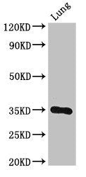 Western Blot Positive WB detected in: Mouse lung tissue All lanes: DPM1 antibody at 3ug/ml Secondary Goat polyclonal to rabbit IgG at 1/50000 dilution Predicted band size: 30 kDa Observed band size: 30 kDa