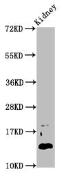 Western Blot Positive WB detected in: Mouse kidney tissue All lanes: DPPA5 antibody at 4.6ug/ml Secondary Goat polyclonal to rabbit IgG at 1/50000 dilution Predicted band size: 14 kDa Observed band size: 14 kDa