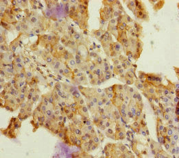 Immunohistochemistry of paraffin-embedded human pancreatic tissue using CSB-PA007156ESR1HU at dilution of 1:100