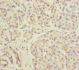 Immunohistochemistry of paraffin-embedded human pancreatic tissue using CSB-PA007156ESR2HU at dilution of 1:100