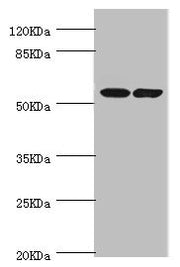 Western blot All lanes: DPYS antibody at 1.1ug/ml Lane 1: Mouse liver tissue Lane 2: Mouse kidney tissue Secondary Goat polyclonal to rabbit IgG at 1/10000 dilution Predicted band size: 57 kDa Observed band size: 57 kDa