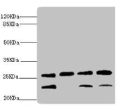 Western blot All lanes: DR1 antibody at 2.32ug/ml Lane 1: Rat gonad tissue Lane 2: PC-3 whole cell lysate Lane 3: Hela whole cell lysate Lane 4: 293T whole cell lysate Secondary Goat polyclonal to rabbit IgG at 1/10000 dilution Predicted band size...