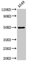 Western Blot Positive WB detected in: A549 whole cell lysate All lanes: DRD1 antibody at 3.5µg/ml Secondary Goat polyclonal to rabbit IgG at 1/50000 dilution Predicted band size: 50 kDa Observed band size: 50 kDa