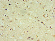Immunohistochemistry of paraffin-embedded human brain tissue using CSB-PA007180ESR1HU at dilution of 1:100