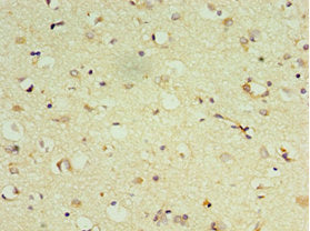 Immunohistochemistry of paraffin-embedded human brain tissue using CSB-PA007180ESR1HU at dilution of 1:100