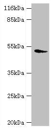 Western blot All lanes: DRD5 antibody at 2µg/ml + Mouse brain tissue Secondary Goat polyclonal to rabbit IgG at 1/10000 dilution Predicted band size: 53 kDa Observed band size: 53 kDa