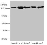 Western blot All lanes: DSC2 antibody at 3.46µg/ml Lane 1: Rat heart tissue Lane 2: A549 whole cell lysate Lane 3: HepG2 whole cell lysate Lane 4: Jurkat whole cell lysate Lane 5: 293T whole cell lysate Secondary Goat polyclonal to rabbit IgG at 1...