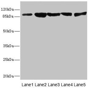 Western blot All lanes: DSC2 antibody at 3.46µg/ml Lane 1: Rat heart tissue Lane 2: A549 whole cell lysate Lane 3: HepG2 whole cell lysate Lane 4: Jurkat whole cell lysate Lane 5: 293T whole cell lysate Secondary Goat polyclonal to rabbit IgG at 1...