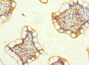 Immunohistochemistry of paraffin-embedded human small intestine tissue using CSB-PA007190ESR2HU at dilution of 1:100