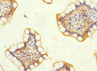 Immunohistochemistry of paraffin-embedded human small intestine tissue using CSB-PA007190ESR2HU at dilution of 1:100