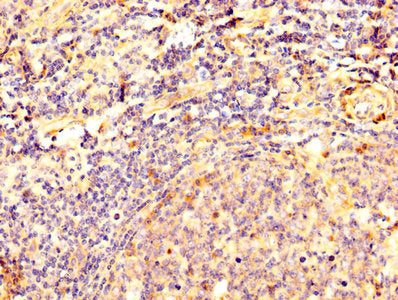 IHC image of CSB-PA007205LA01HU diluted at 1:500 and staining in paraffin-embedded human tonsil tissue performed on a Leica BondTM system. After dewaxing and hydration, antigen retrieval was mediated by high pressure in a citrate buffer (pH 6.0)....