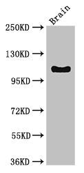 Western Blot Positive WB detected in: Mouse brain tissue All lanes: DSG3 antibody at 3ug/ml Secondary Goat polyclonal to rabbit IgG at 1/50000 dilution predicted band size: 108 kDa observed band size: 108 kDa
