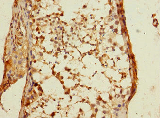 Immunohistochemistry of paraffin-embedded human testis tissue using CSB-PA007213ESR2HU at dilution of 1:100