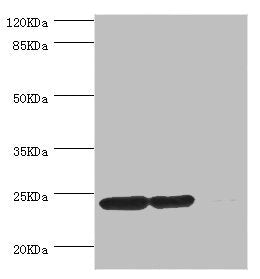 Western blot All lanes: DTYMK antibody at 5.15ug/ml Lane 1: Hela whole cell lysate Lane 2: HepG2 whole cell lysate Lane 3: Rat gonad tissue Secondary Goat polyclonal to rabbit IgG at 1/10000 dilution Predicted band size: 24, 22 kDa Observed band s...