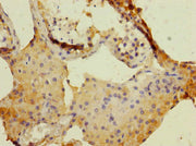 Immunohistochemistry of paraffin-embedded human testis tissue using CSB-PA007228ESR2HU at dilution of 1:100