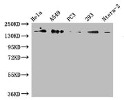 Western Blot Positive WB detected in: Hela whole cell lysate, A549 whole cell lysate, PC3 whole cell lysate, 293 whole cell lysate, Ntera-2 whole cell lysate All lanes: DUOX2 antibody at 1:500 Secondary Goat polyclonal to rabbit IgG at 1/50000 dil...